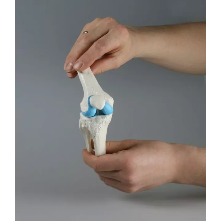 Modèle implant genou