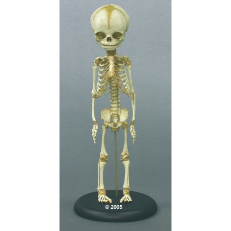 Squelette d'un foetus, 30 ème semaine de grossesse