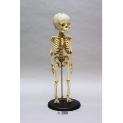 Squelette d'enfant, 14 - 16 mois