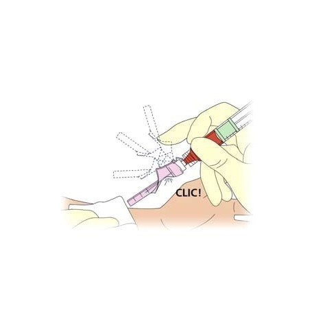 Seringues BD PresetTM 3 ml Luer-Lock p/ prélèvement de sang artériel avec aiguille BD EclipseTM pré-assemblée