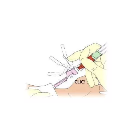 Seringues BD PresetTM 3 ml Luer-Lock p/ prélèvement de sang artériel avec aiguille BD EclipseTM pré-assemblée