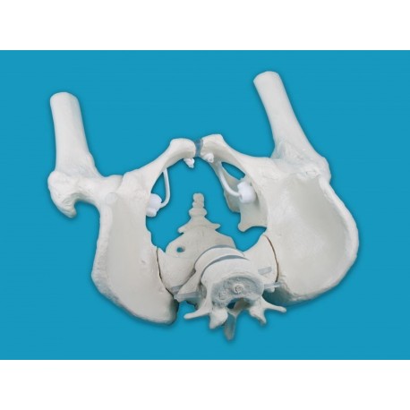 Male pelvis with sacrum, 2 lumbar vertebrae and femoral stumps