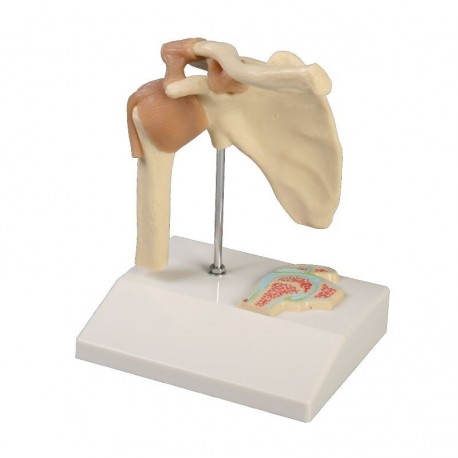 Articulation miniature de l'épaule avec coupe transversale