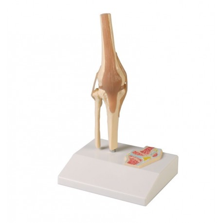 Articulation de genou miniature avec coupe transversale
