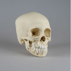 Crâne d'un enfant de 12 ans