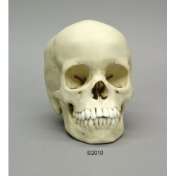 Crâne d'un enfant de 13 ans