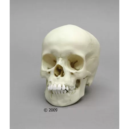 Crâne d'un enfant de 9 ans