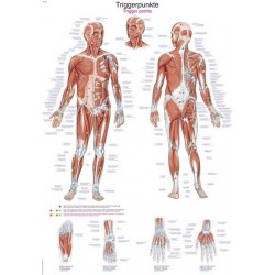 Planche anatomique Points Trigger