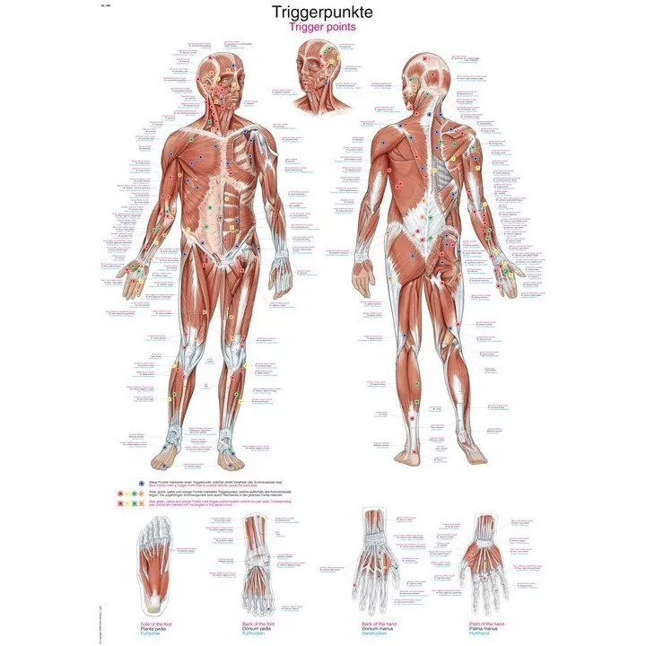 Planche anatomique Points Trigger