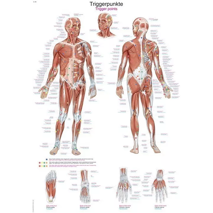 Planche anatomique Points Trigger