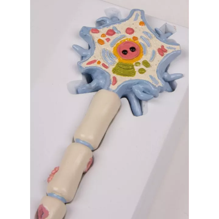 Modèle de neurones avec étapes de la sclérose en plaques