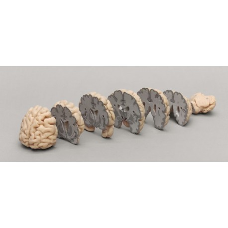 Cerveau humain avec sections frontales