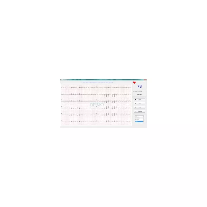 ECG numérique PC SE-1010 Edan, 12 dérivations