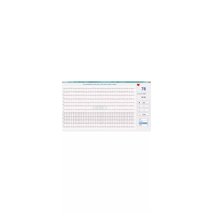 ECG numérique PC SE-1010 Edan, 12 dérivations