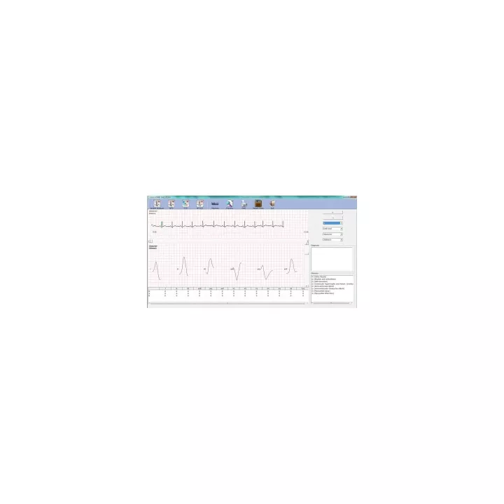 ECG numérique PC SE-1010 Edan, 12 dérivations