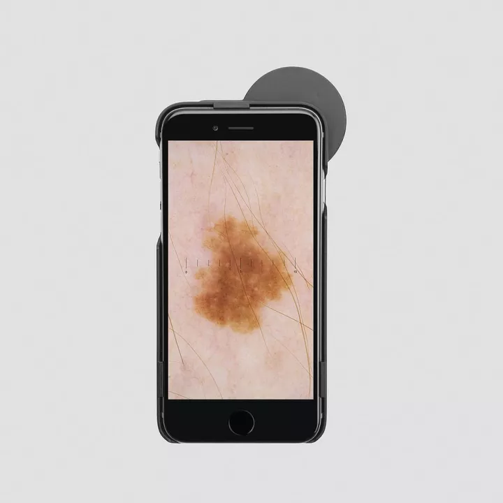 Set HEINE iC1 set/6 pour iPhone 6 / 6 s