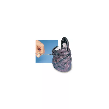 Modèle de Cancer du poumon