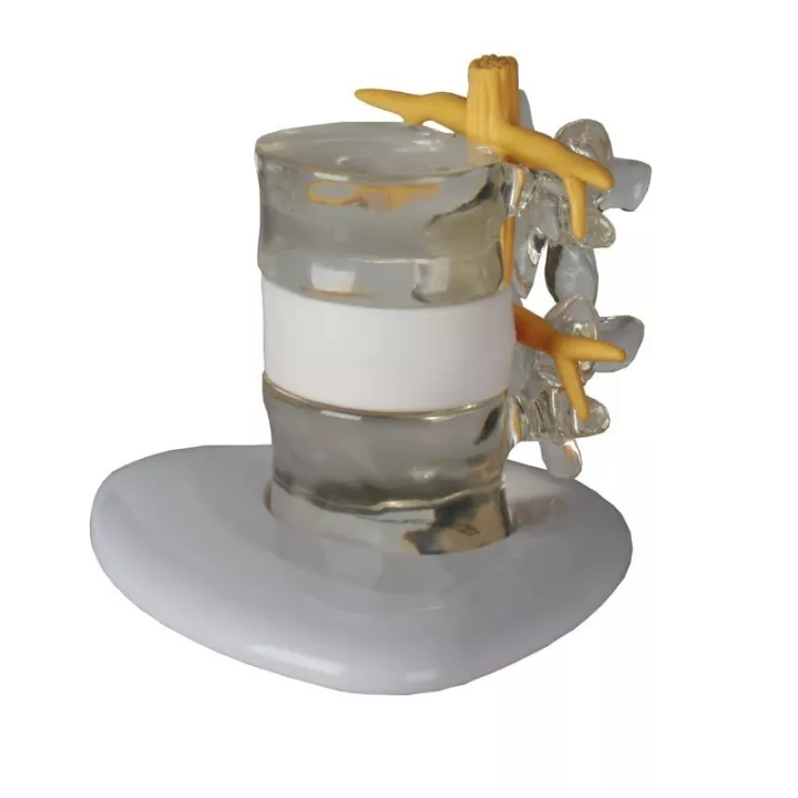 Simulateur de hernie discale