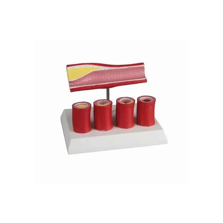 Modèle d'artère avec 4 sections artérielles