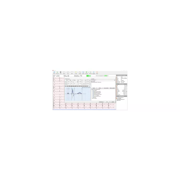 Cardiomate PC- ECG bluetooth Spengler
