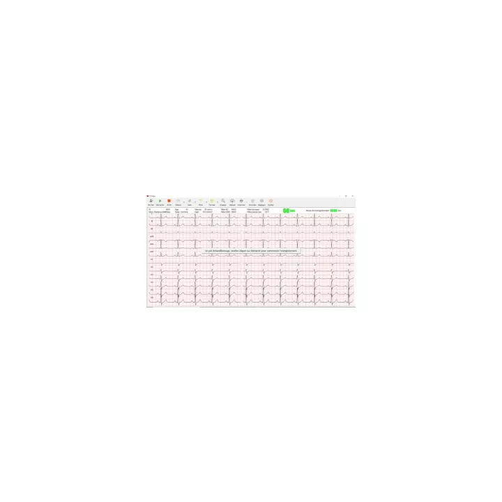 Cardiomate PC- ECG bluetooth Spengler
