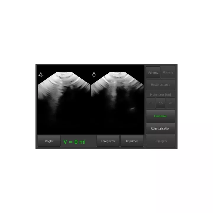 Bladder scanner VITASCAN USB avec logiciel sans tablette