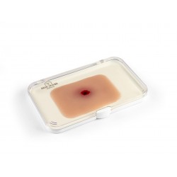 Entrée blessure par balle