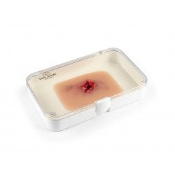 Sortie blessure par balle