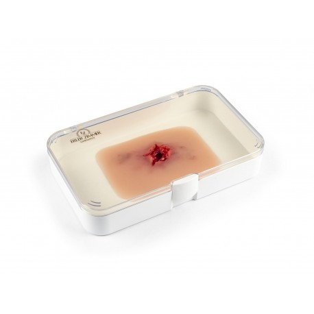 Sortie blessure par balle