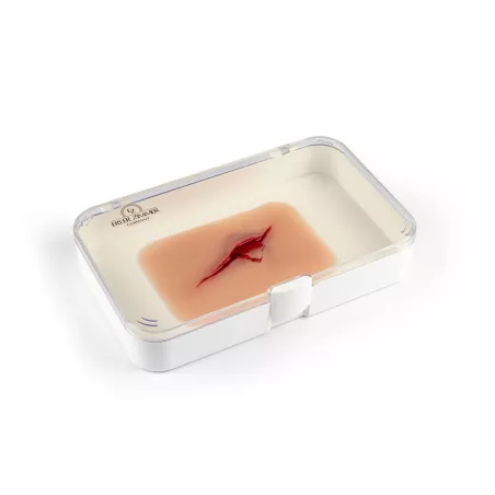 Modèle d'une coupure avec éclats de verre