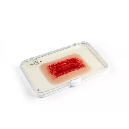 Modèle d'une écorchure par abrasion