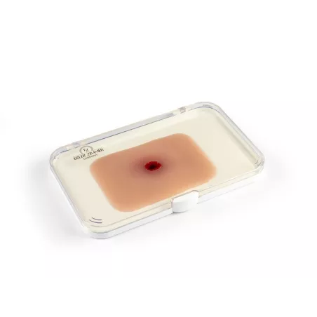 Entrée blessure par balle
