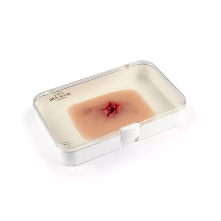 Sortie blessure par balle