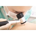 Dermatoscope