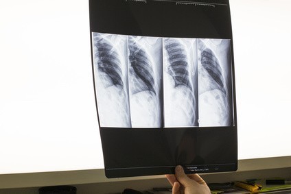 Négatoscope