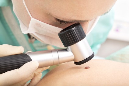 Dermatoscope